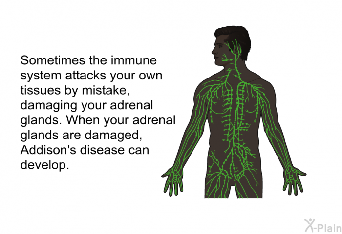 Sometimes the immune system attacks your own tissues by mistake, damaging your adrenal glands. When your adrenal glands are damaged, Addison's disease can develop.