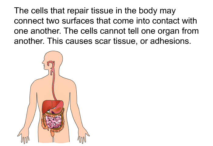 The cells that repair tissue in the body may connect two surfaces that come into contact with one another. The cells cannot tell one organ from another. This causes scar tissue, or adhesions.
