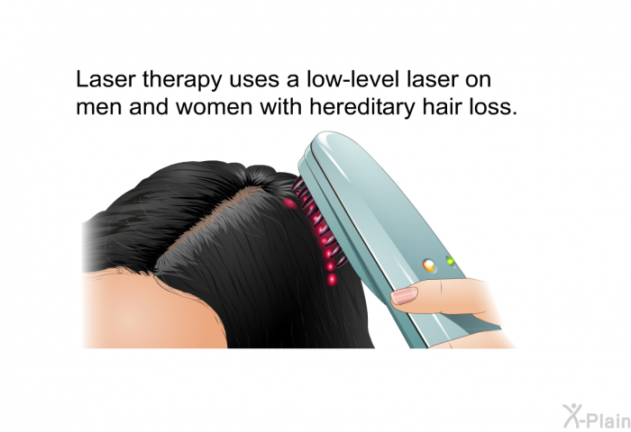Laser therapy uses a low-level laser on men and women with hereditary hair loss.