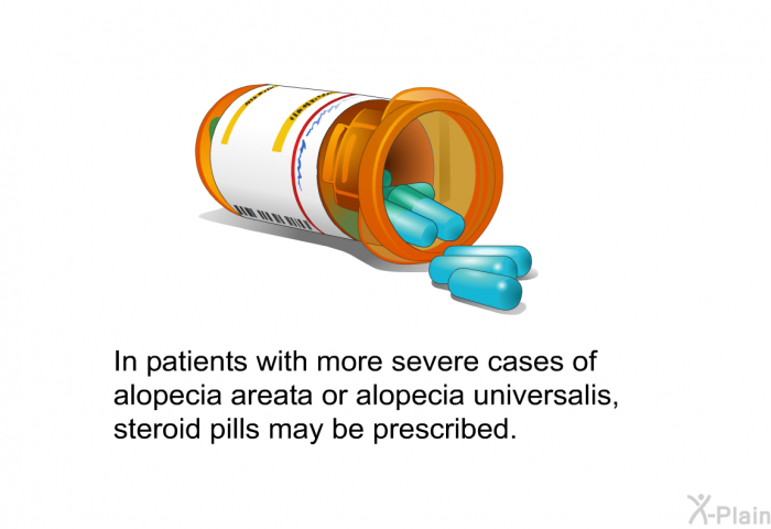 In patients with more severe cases of alopecia areata or alopecia universalis, steroid pills may be prescribed.