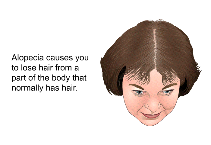 Alopecia causes you to lose hair from a part of the body that normally has hair.