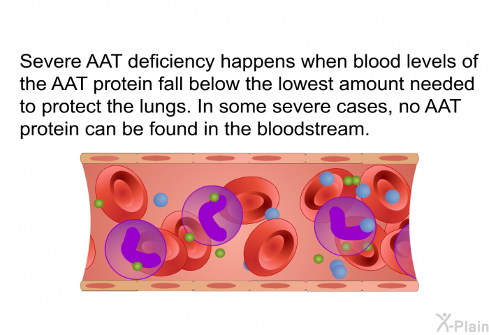 Severe AAT deficiency happens when blood levels of the AAT protein fall below the lowest amount needed to protect the lungs. In some severe cases, no AAT protein can be found in the bloodstream.