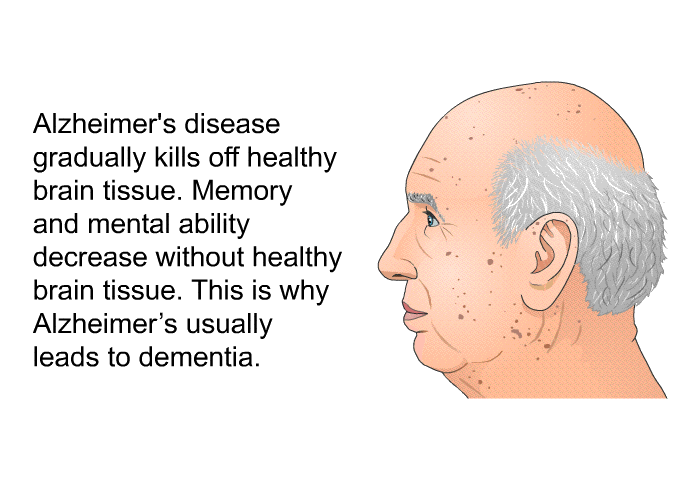 Alzheimer's disease gradually kills off healthy brain tissue. Memory and mental ability decrease without healthy brain tissue. This is why Alzheimer's usually leads to dementia.