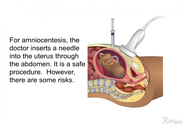 For amniocentesis, the doctor inserts a needle into the uterus through the abdomen. It is a safe procedure. However, there are some risks.
