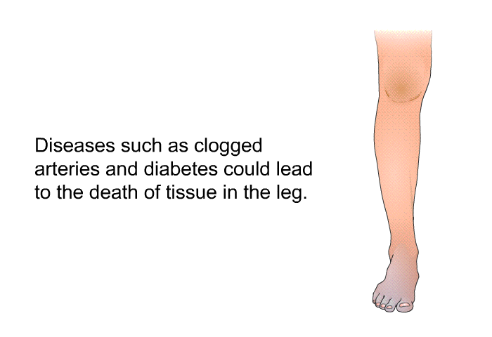 Diseases such as clogged arteries and diabetes could lead to the death of tissue in the leg.