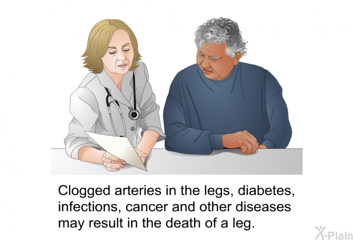 Clogged arteries in the legs, diabetes, infections, cancer and other diseases may result in the death of a leg.