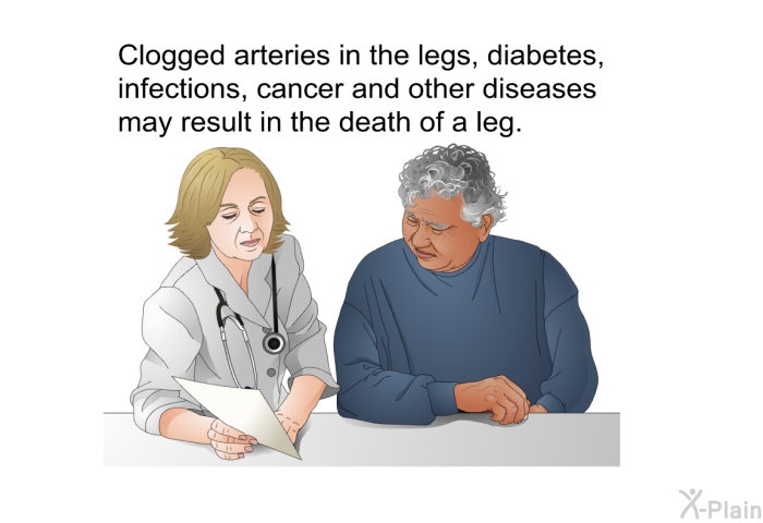 Clogged arteries in the legs, diabetes, infections, cancer and other diseases may result in the death of a leg.