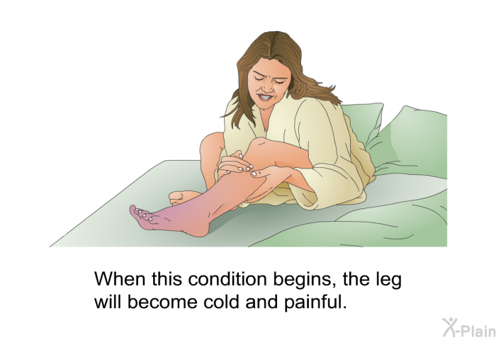 When this condition begins, the leg will become cold and painful.