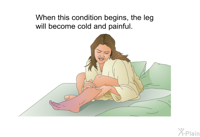 When this condition begins, the leg will become cold and painful.