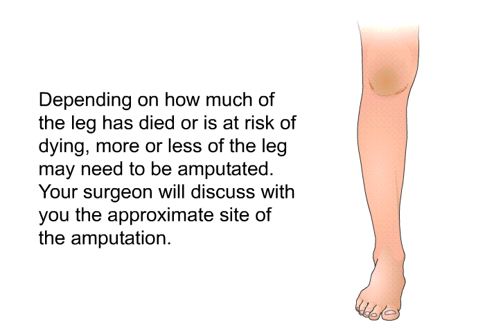 Depending on how much of the leg has died or is at risk of dying, more or less of the leg may need to be amputated. Your surgeon will discuss with you the approximate site of the amputation.