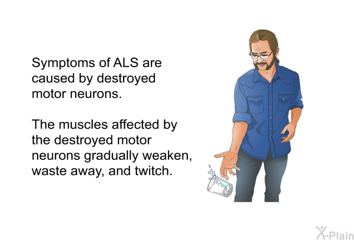 Symptoms of ALS are caused by destroyed motor neurons. The muscles affected by the destroyed motor neurons gradually weaken, waste away and twitch.
