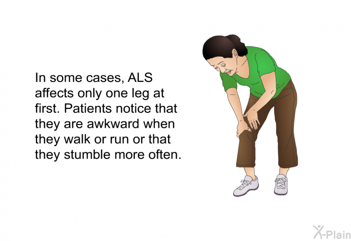 In some cases, ALS affects only one leg at first. Patients notice that they are awkward when they walk or run or that they stumble more often.