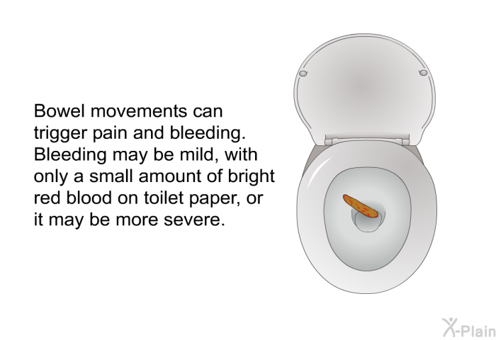 Bowel movements can trigger pain and bleeding. Bleeding may be mild, with only a small amount of bright red blood on toilet paper, or it may be more severe.