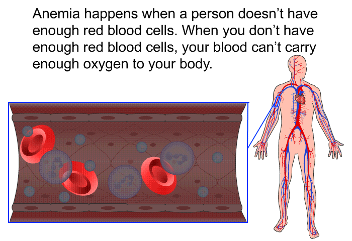 Anemia happens when a person doesn't have enough red blood cells. When you don't have enough red blood cells, your blood can't carry enough oxygen to your body.