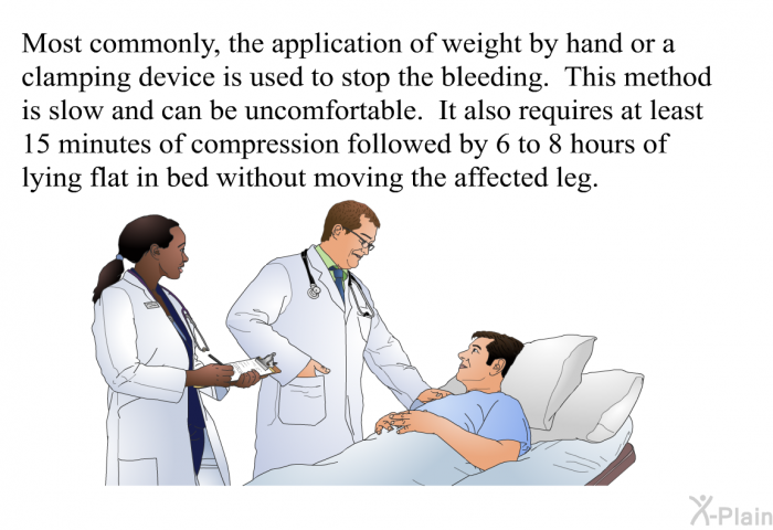 Most commonly, the application of weight by hand or a clamping device is used to stop the bleeding. This method is slow and can be uncomfortable. It also requires at least 15 minutes of compression followed by 6 to 8 hours of lying flat in bed without moving the affected leg.