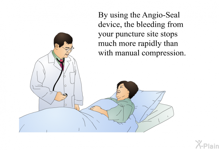 By using the Angio-Seal device, the bleeding from your puncture site stops much more rapidly than with manual compression.