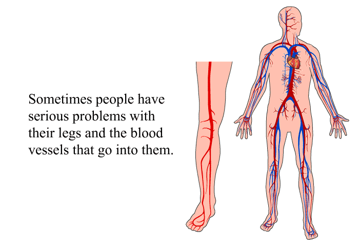 Sometimes people have serious problems with their legs and the blood vessels that go into them.