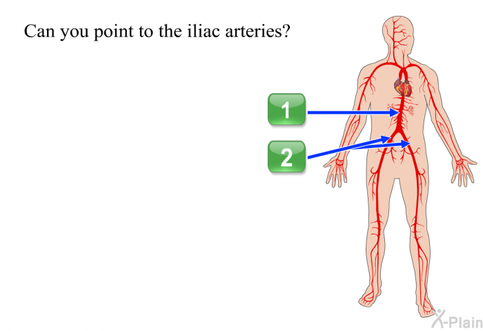 Can you point to the iliac arteries?