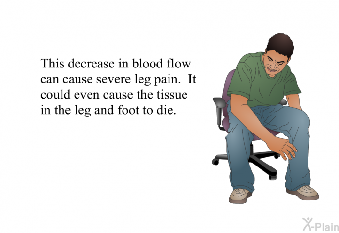 This decrease in blood flow can cause severe leg pain. It could even cause the tissue in the leg and foot to die.