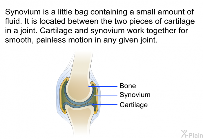 Synovium is a little bag containing a small amount of fluid. It is located between the two pieces of cartilage in a joint. Cartilage and synovium work together for smooth, painless motion in any given joint.