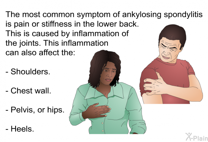 The most common symptom of ankylosing spondylitis is pain or stiffness in the lower back. This is caused by inflammation of the joints. This inflammation can also affect the:  Shoulders. Chest wall. Pelvis, or hips. Heels.