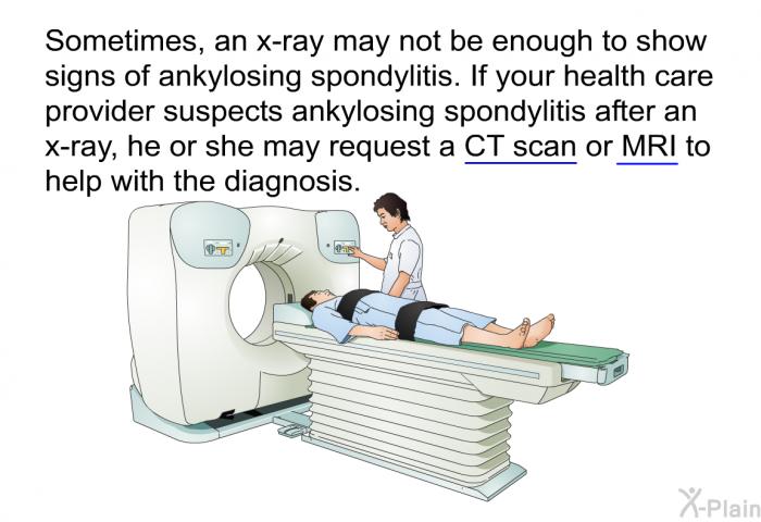 Sometimes, an x-ray may not be enough to show signs of ankylosing spondylitis. If your health care provider suspects ankylosing spondylitis after an x-ray, he or she may request a CT scan or MRI to help with the diagnosis.
