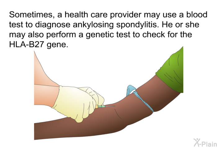 Sometimes, a health care provider may use a blood test to diagnose ankylosing spondylitis. He or she may also perform a genetic test to check for the HLA-B27 gene.