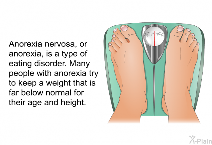 Anorexia nervosa, or anorexia, is a type of eating disorder. Many people with anorexia try to keep a weight that is far below normal for their age and height.