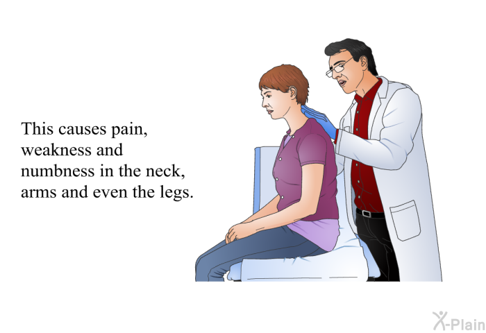 This causes pain, weakness and numbness in the neck, arms and even the legs.
