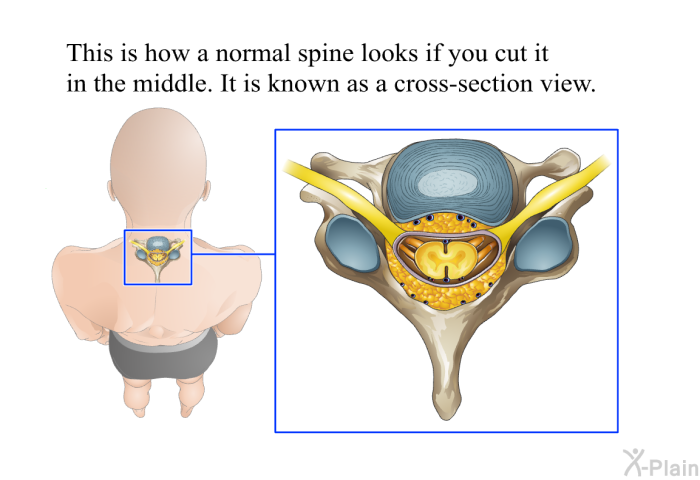 This is how a normal spine looks if you cut it in the middle. It is known as a cross-section view.