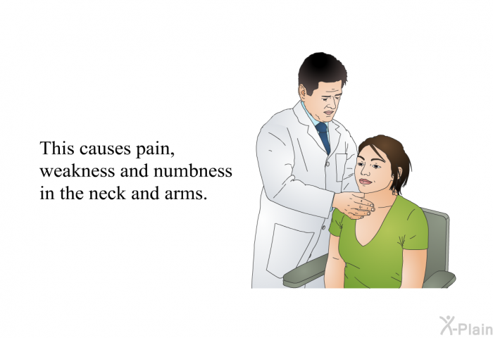 This causes pain, weakness and numbness in the neck and arms.
