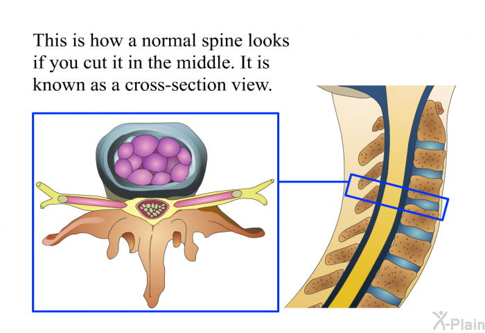 This is how a normal spine looks if you cut it in the middle. It is known as a cross-section view.