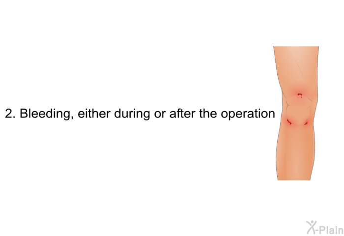 Bleeding, either during or after the operation