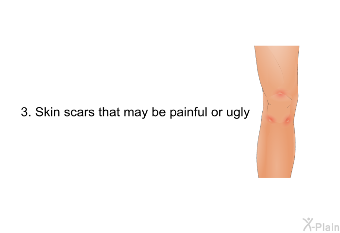 Skin scars that may be painful or ugly