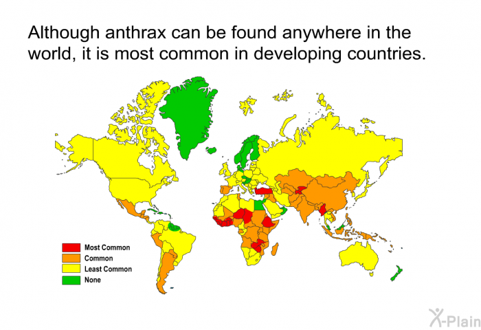 Although anthrax can be found anywhere in the world, it is most common in developing countries.