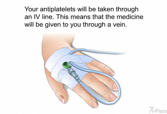 Your antiplatelets will be taken through an IV line. This means that the medicine will be given to you through a vein.