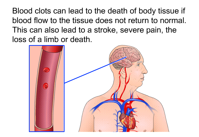 Blood clots can lead to the death of body tissue if blood flow to the tissue does not return to normal. This can also lead to a stroke, severe pain, the loss of a limb or death.