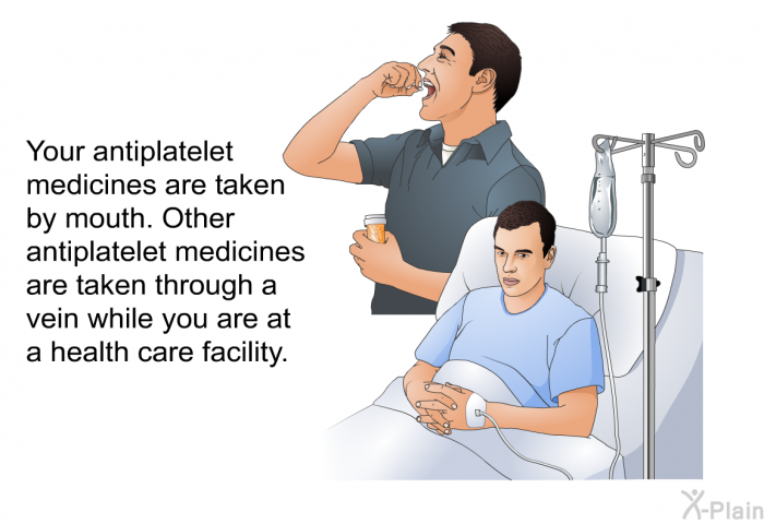 Your antiplatelet medicines are taken by mouth. Other antiplatelet medicines are taken through a vein while you are at a health care facility.