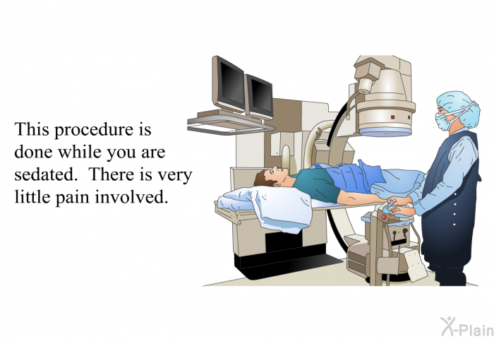 This procedure is done while you are sedated. There is very little pain involved.