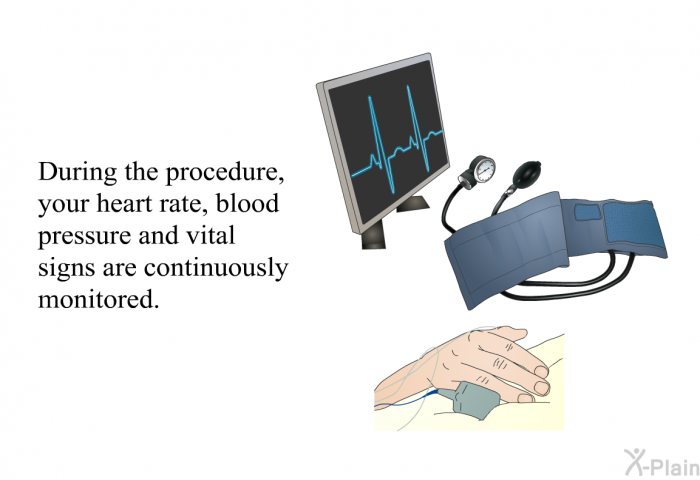 During the procedure, your heart rate, blood pressure and vital signs are continuously monitored.