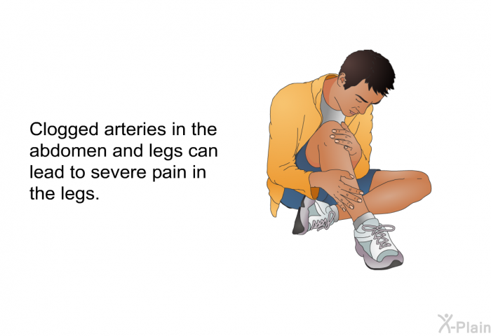 Clogged arteries in the abdomen and legs can lead to severe pain in the legs.