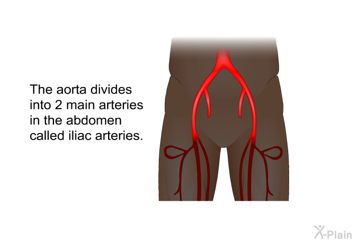 The aorta divides into 2 main arteries in the abdomen called iliac arteries.