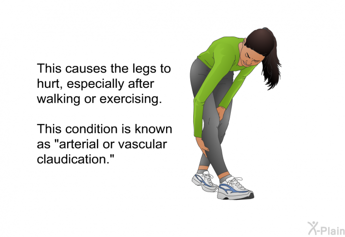 This causes the legs to hurt, especially after walking or exercising. This condition is known as "arterial or vascular claudication."