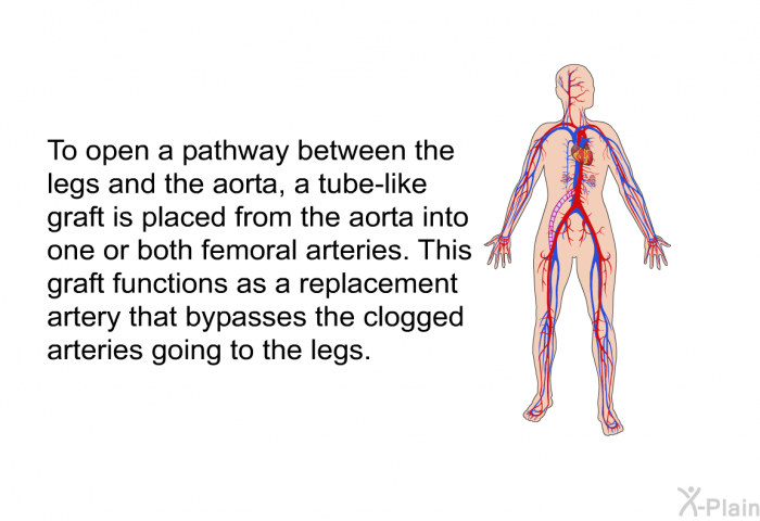 To open a pathway between the legs and the aorta, a tube-like graft is placed from the aorta into one or both femoral arteries. This graft functions as a replacement artery that bypasses the clogged arteries going to the legs.