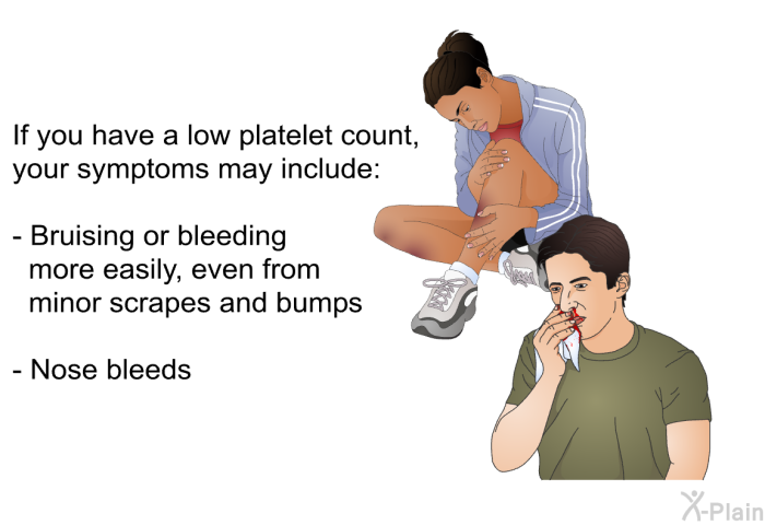 If you have a low platelet count, your symptoms may include:  Bruising or bleeding more easily, even from minor scrapes and bumps Nose bleeds