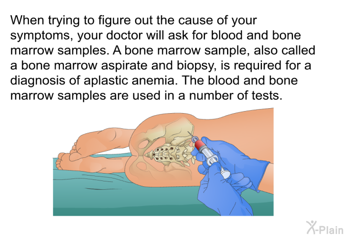 When trying to figure out the cause of your symptoms, your doctor will ask for blood and bone marrow samples. A bone marrow sample, also called a bone marrow aspirate and biopsy, is required for a diagnosis of aplastic anemia. The blood and bone marrow samples are used in a number of tests.
