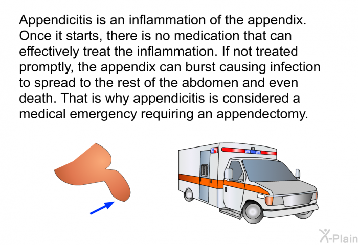 Appendicitis is an inflammation of the appendix. Once it starts, there is no medication that can effectively treat the inflammation. If not treated promptly, the appendix can burst causing infection to spread to the rest of the abdomen and even death. That is why appendicitis is considered a medical emergency requiring an appendectomy.