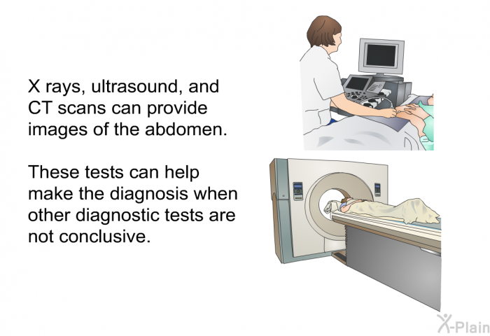 X rays, ultrasound, and CT scans can produce images of the abdomen. These tests can help make the diagnosis when other diagnostic tests are not conclusive.
