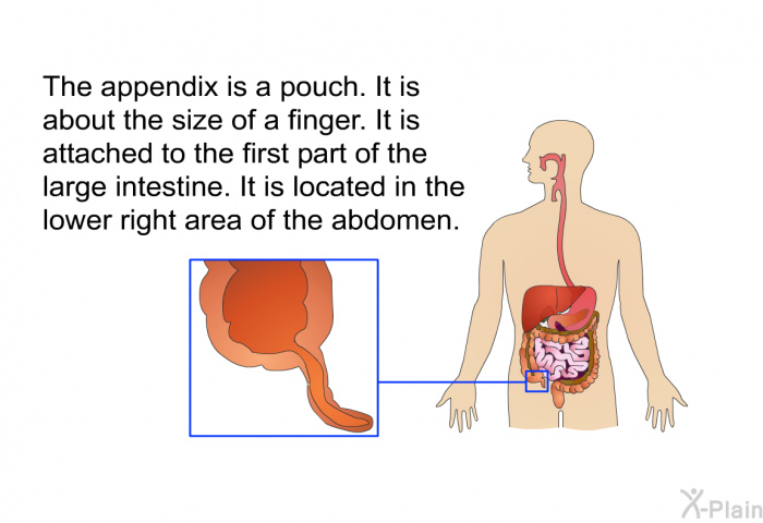 The appendix is a pouch. It is about the size of a finger. It is attached to the first part of the large intestine. It is located in the lower right area of the abdomen.