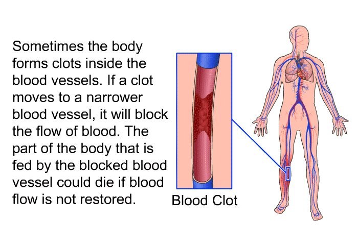 Sometimes the body forms clots inside the blood vessels. If a clot moves to a narrower blood vessel, it will block the flow of blood. The part of the body that is fed by the blocked blood vessel could die if blood flow is not restored.